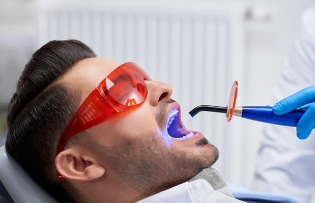 why would dental fillings be needed new